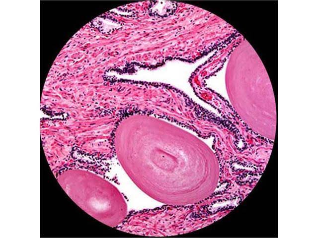Black Binocular Biological Microscope A503462